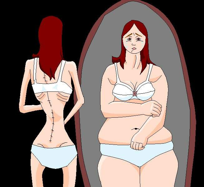 mulher com anorexia - vontade de ficar bonita