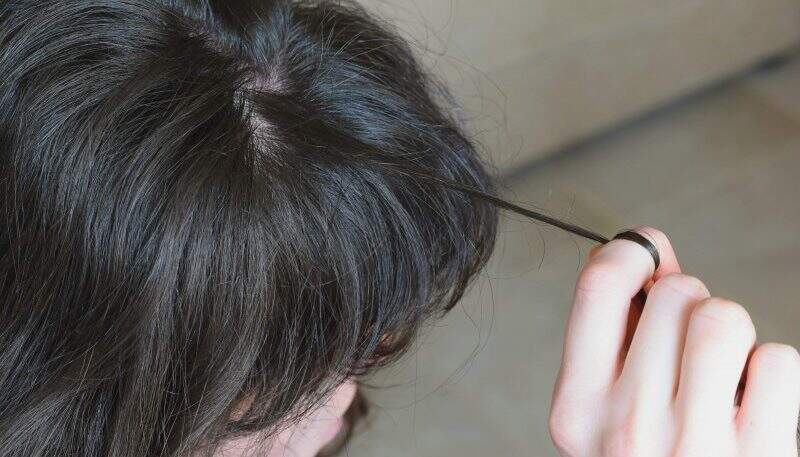 Entenda a tricotilomania ou hábito de arrancar cabelos